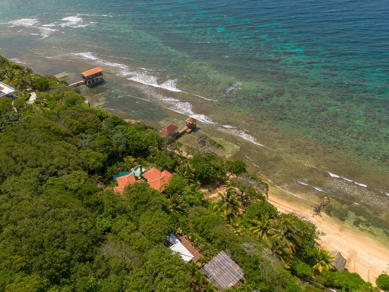 The Casitas at Calabash Bight