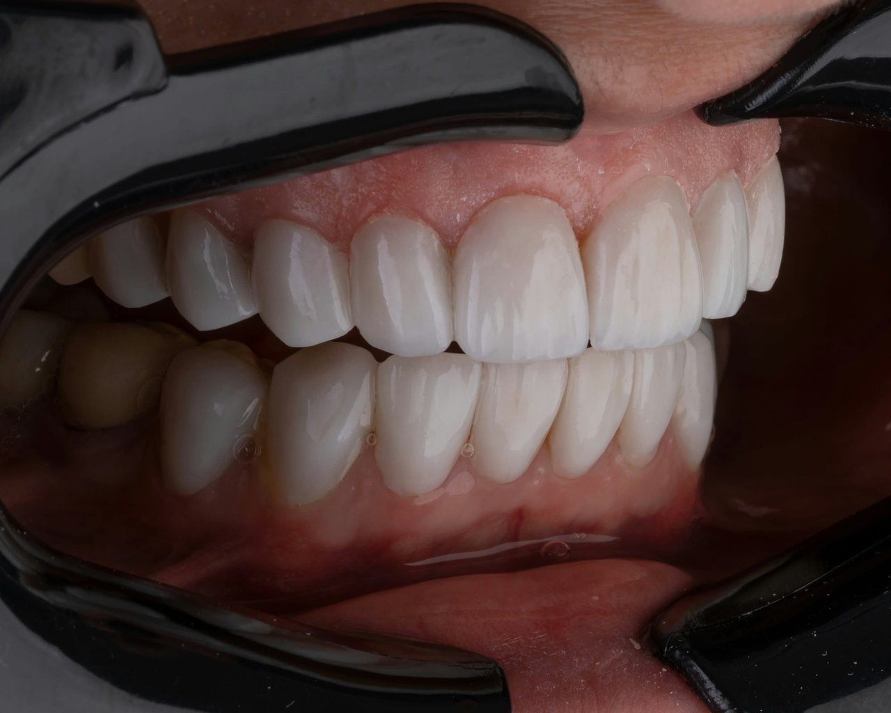 Dental Lab